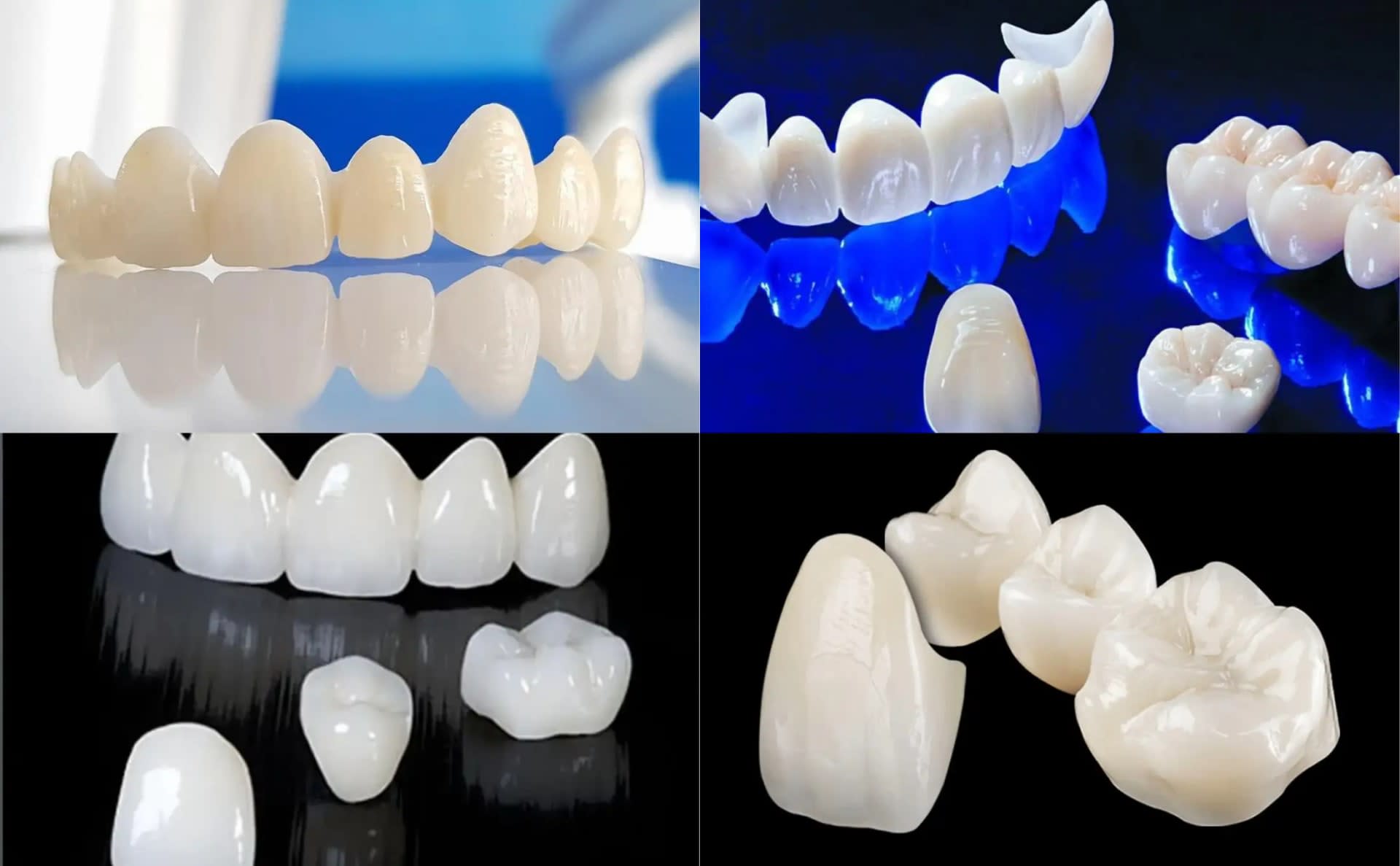 Zirconia Dental Crown Smile Dental Care Treatment in Dhaka - Smile Dental Care