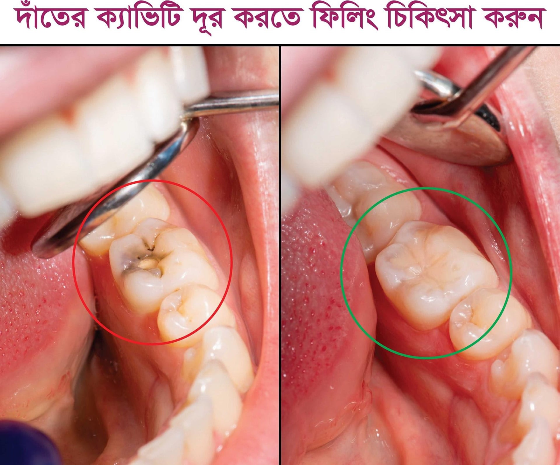 Img 8657 - Top Dental Care Services | Smile Dental Care