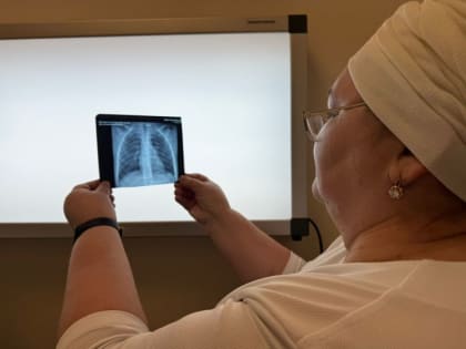 В прошлом году 572 чистопольца заболели внебольничной пневмонией