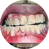 Floss
