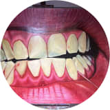Floss