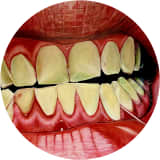 Floss