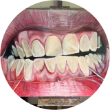 Floss