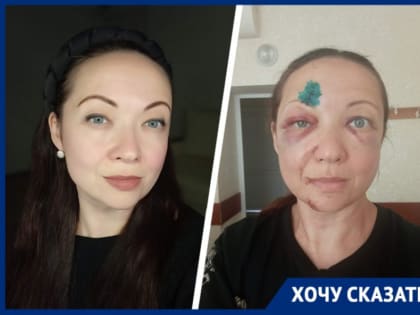 Жительница Железноводска на грани справедливости после аварии с джипом