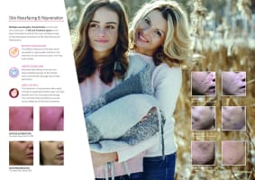 Premium Tattoo Removal & Skin Rejuvenation Laser