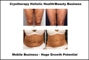 Cryotherapy Cool Sculpting - Fat Freezing Niche - Mobile Business run anywhere!