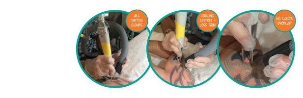 Premium Tattoo Removal & Skin Rejuvenation Laser