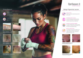 Premium Tattoo Removal & Skin Rejuvenation Clinic in Lane Cove, NSW