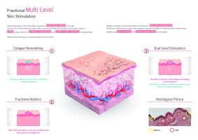 Premium Tattoo Removal & Skin Rejuvenation Clinic in Lane Cove, NSW