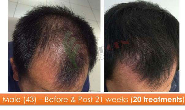 K0r1vw6spifdm4awcveq