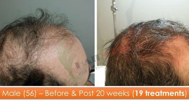 Mdkfog6ungxhnzzhboux