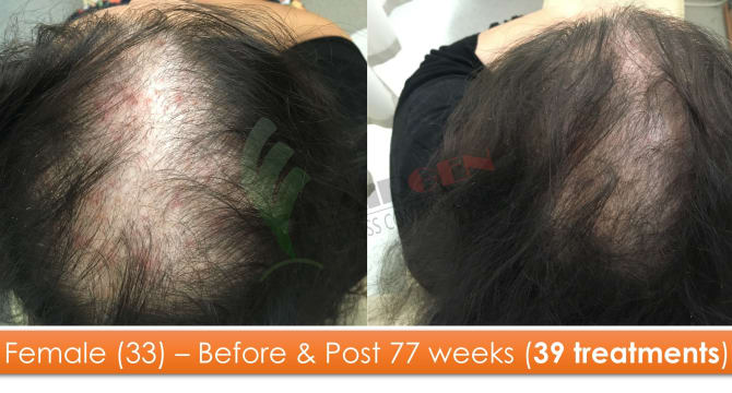 Mzo4gqenzxu7p9bzryrs