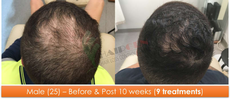 Plk5g7shubrc7y0p8ajb