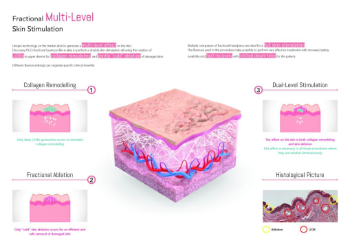 Premium Tattoo Removal & Skin Rejuvenation Laser