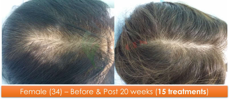 Uwr6w1ywjteao66sufgd