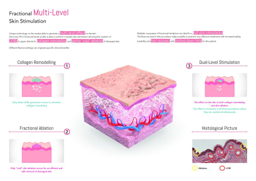 Premium Tattoo Removal & Skin Rejuvenation Clinic in Lane Cove, NSW