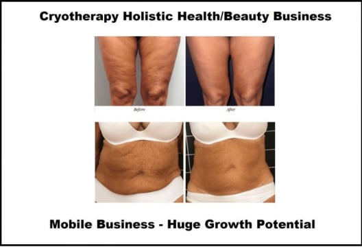 Cryotherapy Cool Sculpting - Fat Freezing Niche - Mobile Business run anywhere!