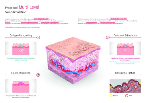 Premium Tattoo Removal & Skin Rejuvenation Laser