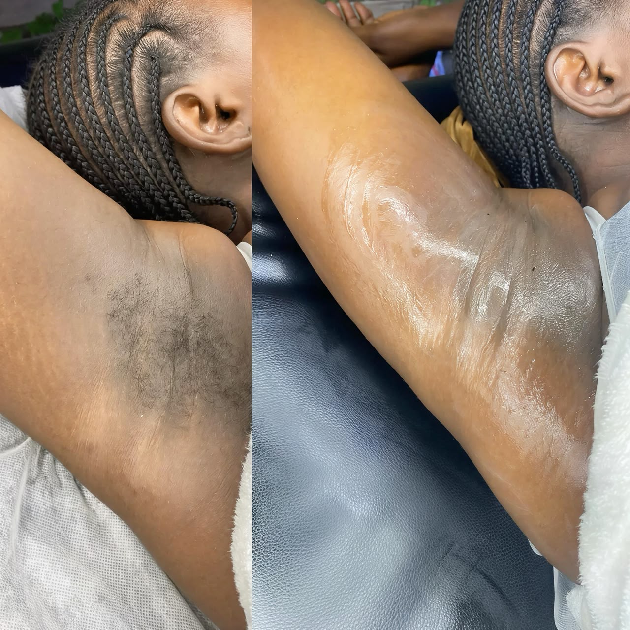 Underarm Waxing