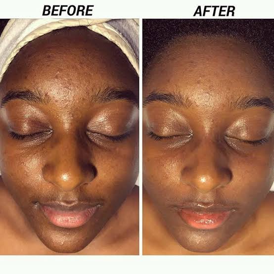 Anti-Aging Facial