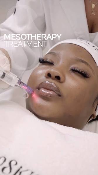 Mesotherapy Facial