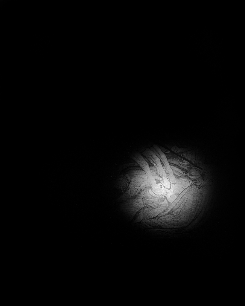 Bdelygmia