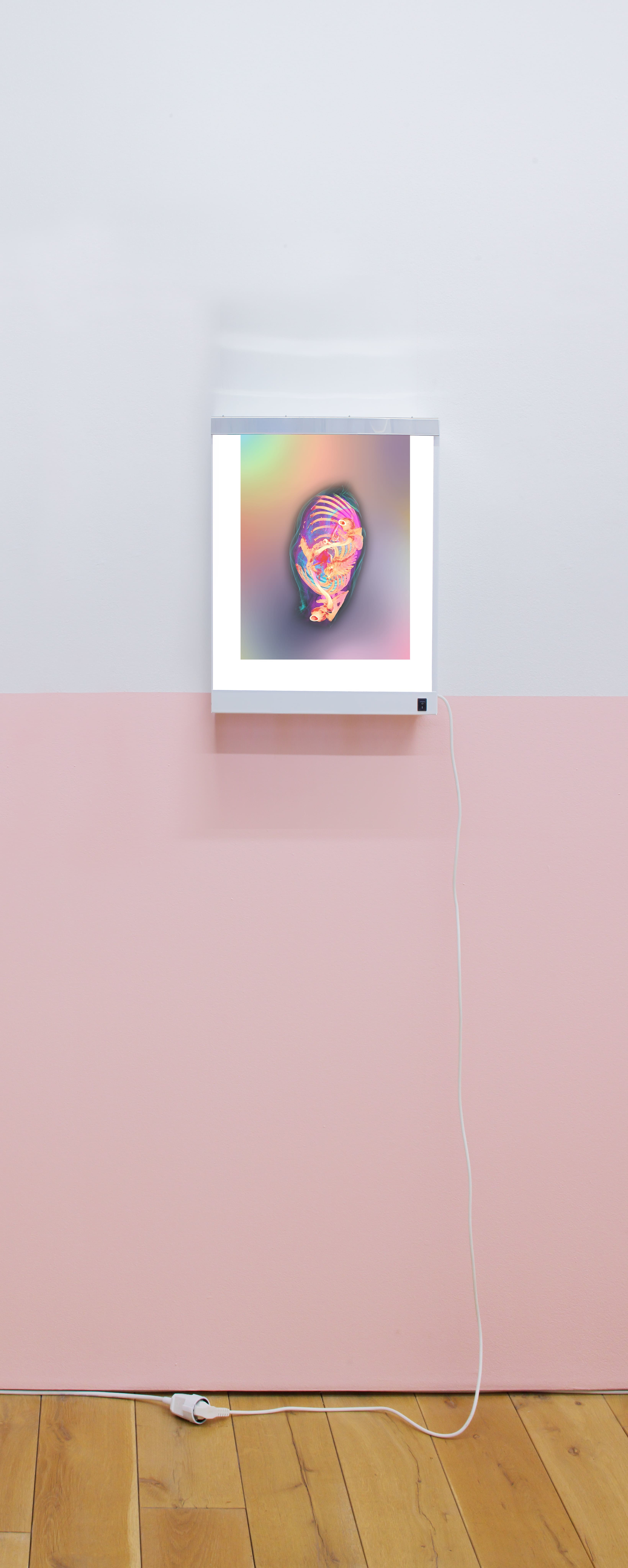 X Ray Viewer Adrien 1