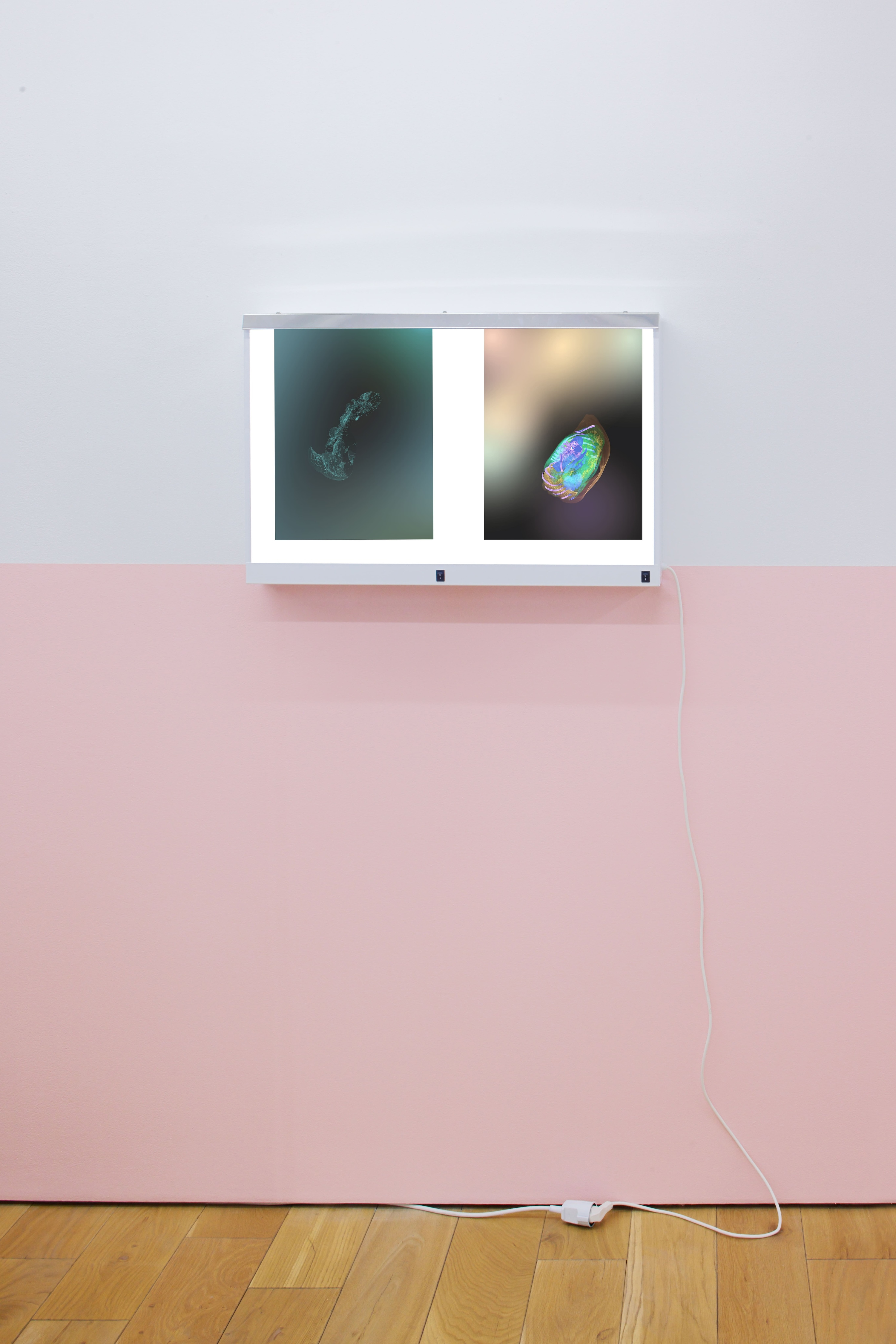 X Ray Viewer