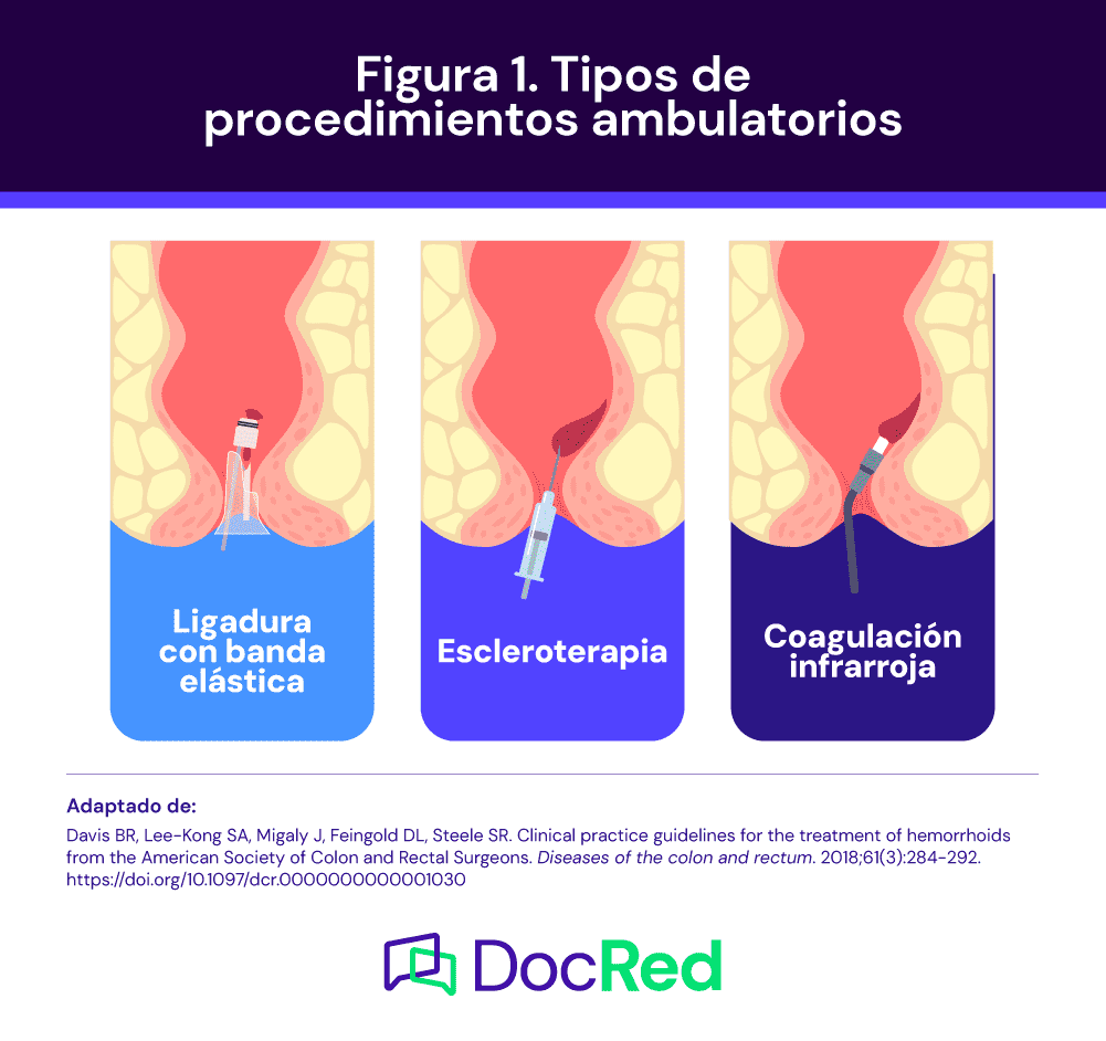 hemorroides tratamiento pdf