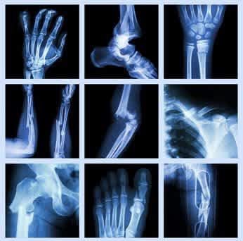 Dr Jerome Proust Chirurgien Orthopediste A Limoges