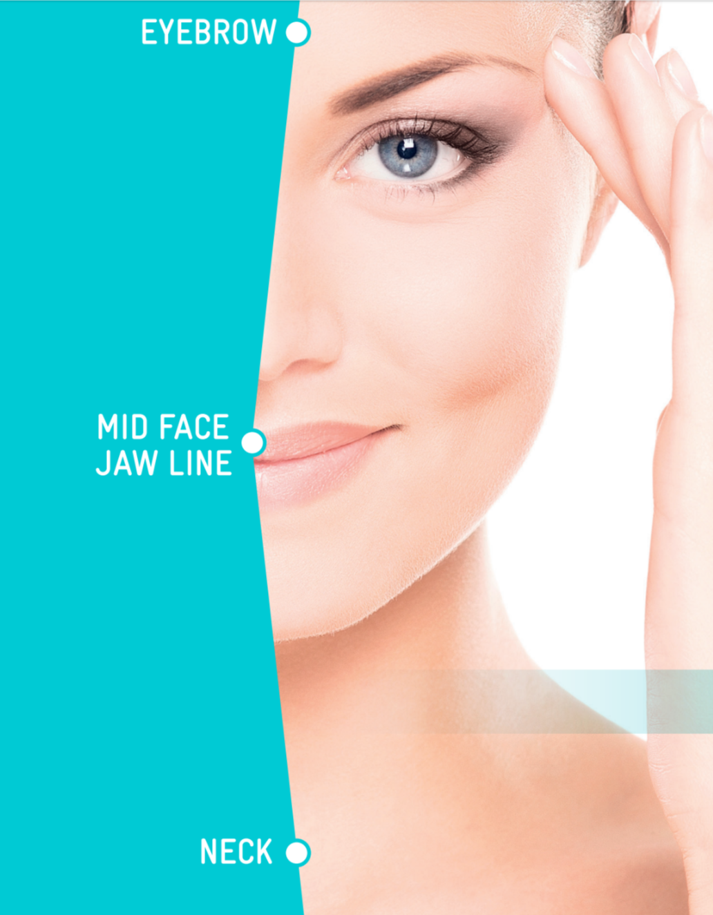 Silhouette Soft threads for non-surgical facelift and necklift in Manchester and Wilmslow Cheshire