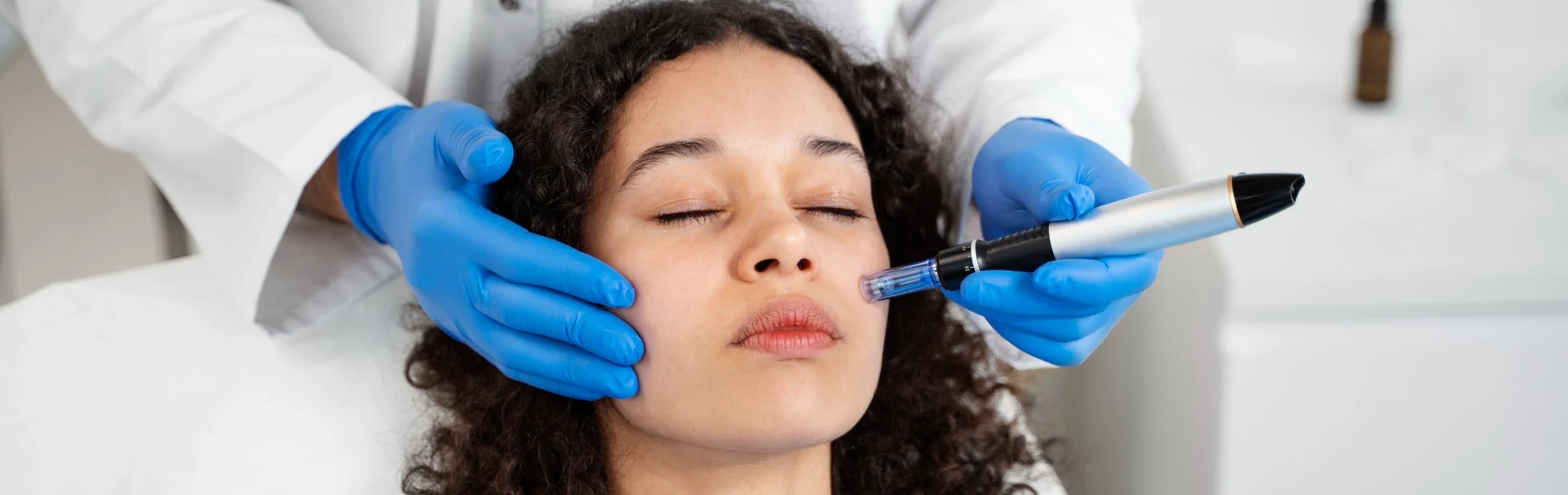 Microneedling