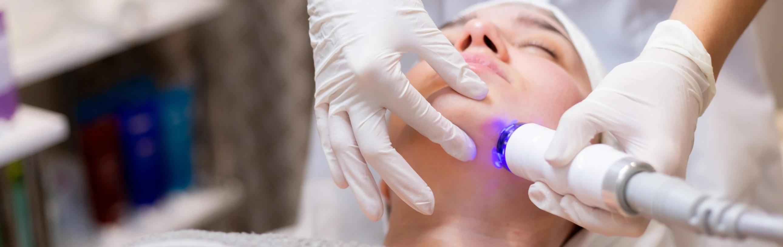 K-Laser Blue Treatment