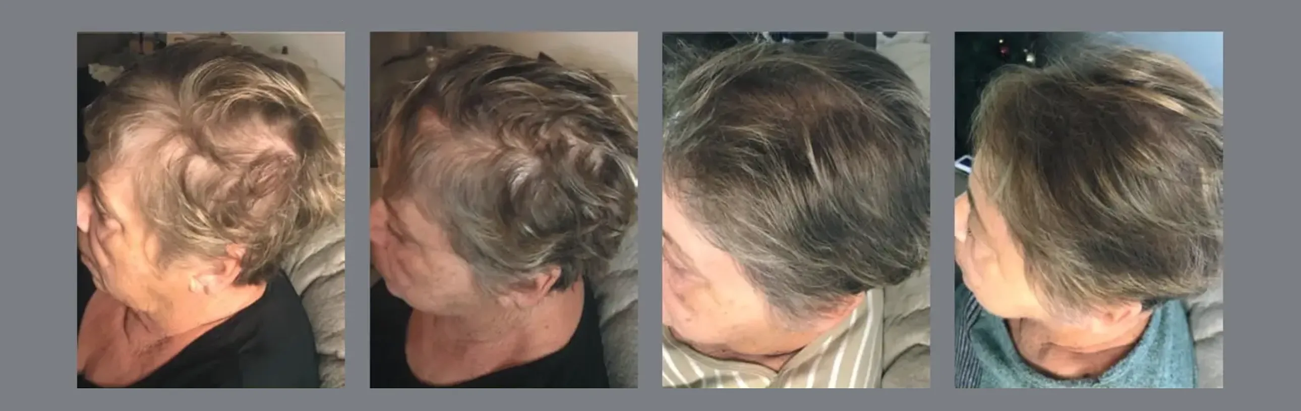 Hair treatments in Nottingham: restore strength, thickness and confidence