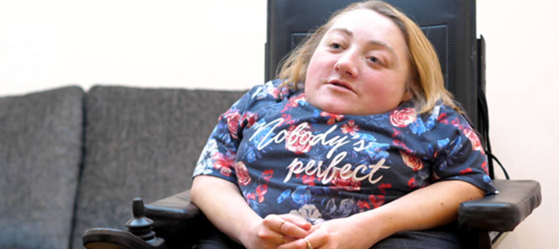 A woman sits in a wheelchair A woman sits in a wheelchair