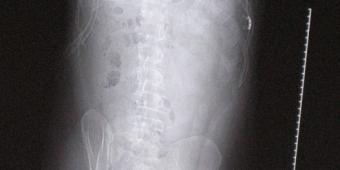 Spinal Research set to build on significant research developments