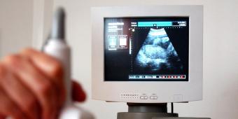 Maria Caulfield’s ‘baseless claims’ about abortion are concerning
