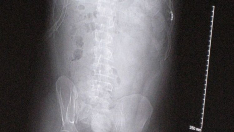 Spinal Research set to build on significant research developments