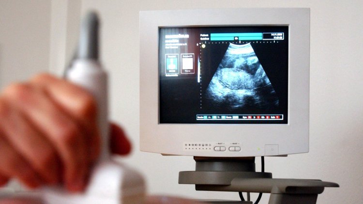 Maria Caulfield’s ‘baseless claims’ about abortion are concerning
