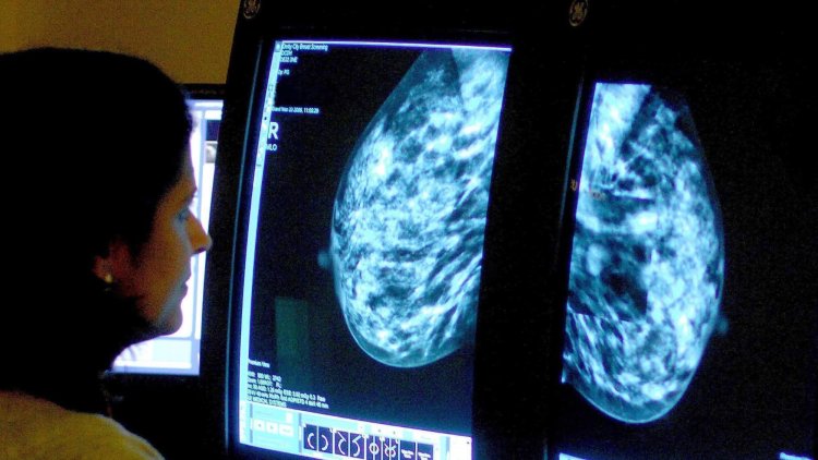 Women have the right to know that there is help to reduce pain during mammograms