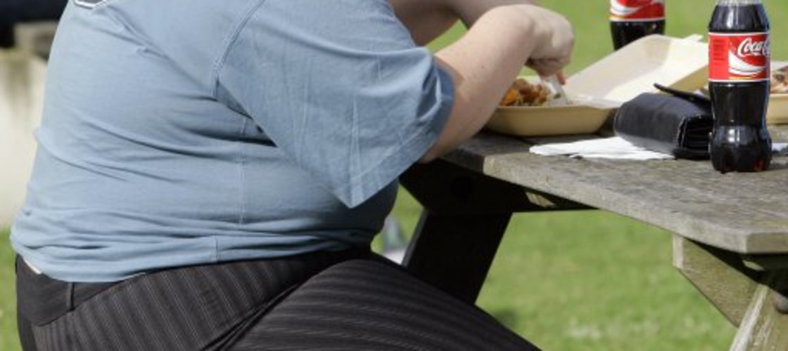Obesity Obesity