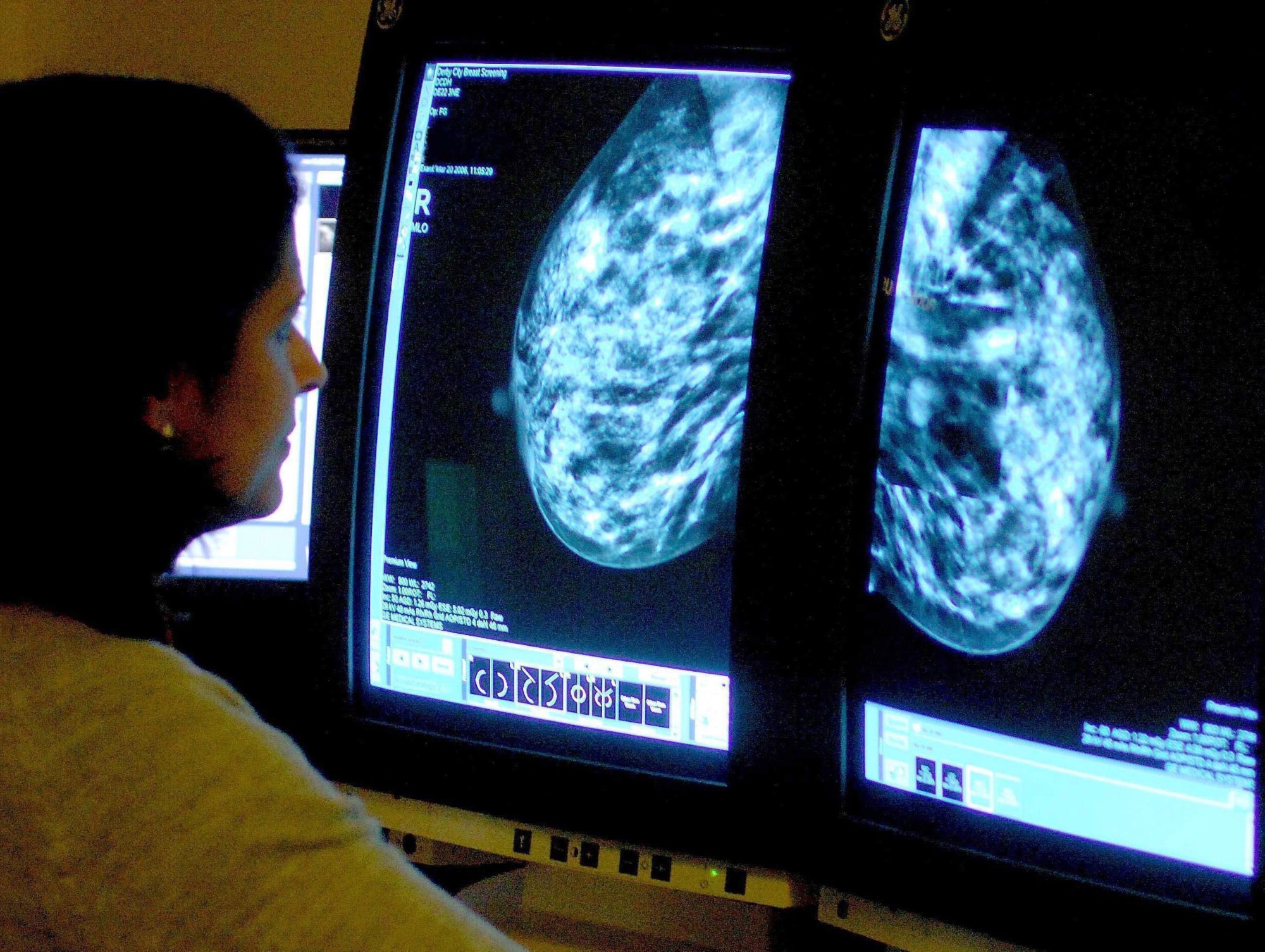 Consultant analysing a mammogram Consultant analysing a mammogram