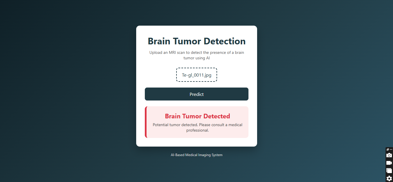 Brian Tumor Detector