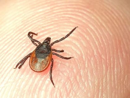 Житель Алтайского края попал в больницу с тяжелой формой клещевого энцефалита