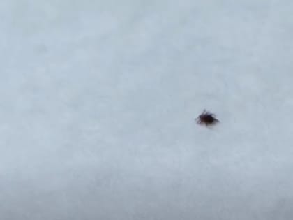 295 жителей Алтайского края пострадали от присасывания клещей за неделю