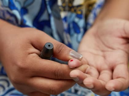 Врач назвала признаки диабета, которые не бросаются в глаза