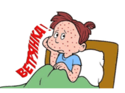 Профилактика ветряной оспы