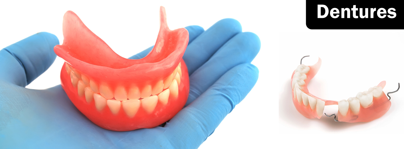 Dentures Treatment at Ridgeway Dental Spa Hinjewadi Pune