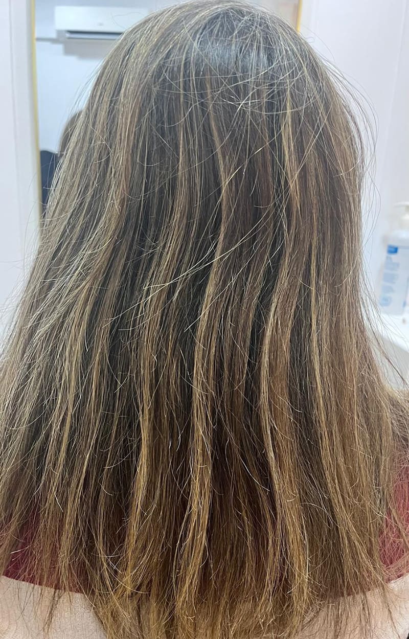 Antes