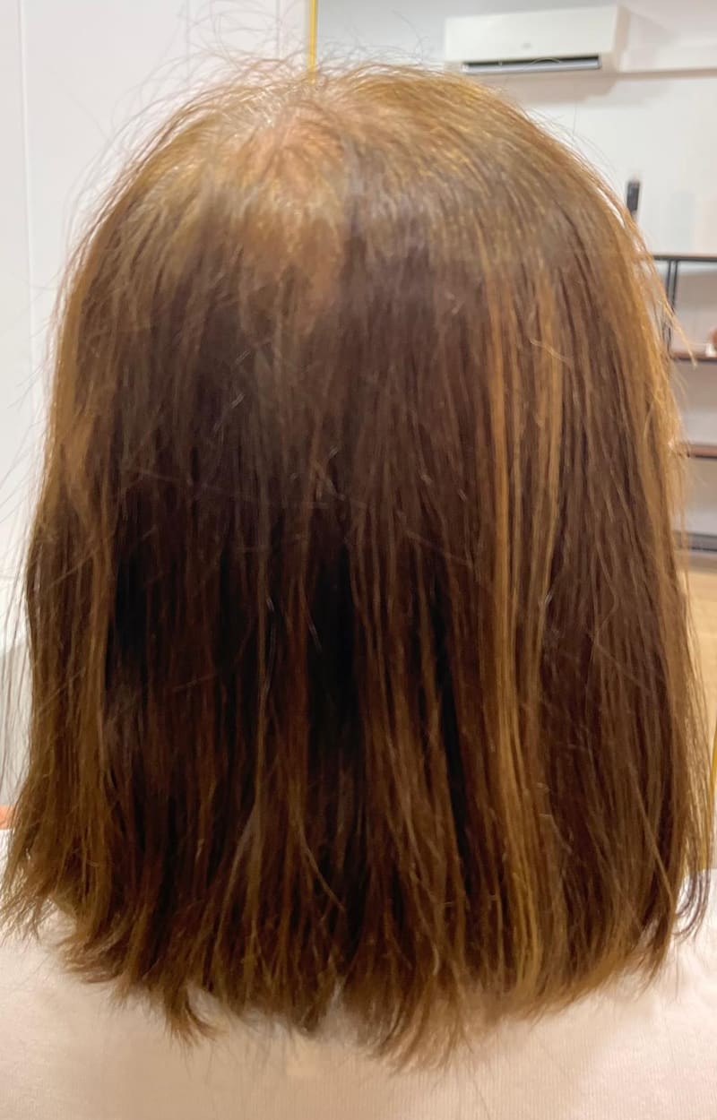 Antes